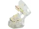 Dental Jaw Model with Orthodontic Braces, 6.5x6.5x7.5 cm