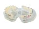 Dental Jaw Model with Orthodontic Braces, 6.5x6.5x7.5 cm