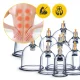 4Fizjo 1170 Fireless Vacuum Cupping Set with Pump, 24 pcs