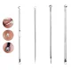 Blackhead removal tool kit with stainless steel loops