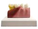 Anatomical Tooth Model for Dental Education with Removable Cross Section Tooth