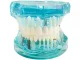 Dental Jaw Model with Implants and 14 Removable Teeth