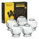 4Fizjo Glass Fire Cupping Set, 20 pcs