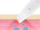 Ultrasonic Facial Cavitation Peeling Device, Cordless