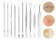 10-piece blackhead removal tool set