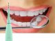 Ultrasonic Dental Scaler For Teeth Cleaning Tartar Removal, Green