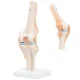 4Fizjo 1073 Anatomical Knee Joint Model 1:1