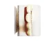 Anatomical Tooth Model with Pathologies, Removable Tooth