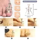 Soulima Ingrown Toenail Kit, 6 Tools