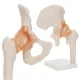 4Fizjo 1253 Anatomical Hip Joint Model with Ligaments, 1:1, White