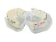 Dental Jaw Model with Orthodontic Braces, 6.5x6.5x7.5 cm