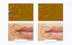 Anlan 01-ADRY15-001 Ultrasonic Facial Massager with Light Therapy