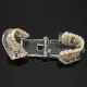 Dental Jaw Model with 14 Removable Teeth & Implants