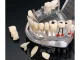 Dental Jaw Model with Implants and 14 Removable Teeth