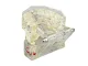 Dental Jaw Model with 14 Removable Teeth & Implants