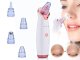 Electric Blackhead Remover Vacuum for Face Rechargeable Microdermabrasion Device
