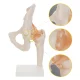 4Fizjo 1253 Anatomical Hip Joint Model with Ligaments, 1:1, White