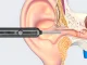 Smart Ear Otoscope Endoscope with WiFi Camera, 6 Tips