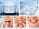 Anti-Snoring Mouth Guard with Protective Storage Case, Clear