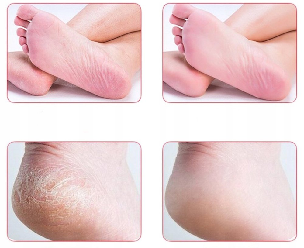 EXO GF-15 Double-Sided Foot File (1)