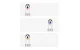 Intelligent Eye Massager Beauty Device for Eye Skin Lifting and Care ANLAN ALMYY06-02