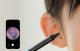 Otoscope Tips Kit Bebird ENT Kit Black 3-Pack