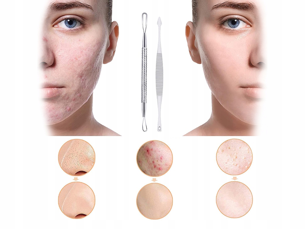 Tools Spoon UNO Vidal Loop for Cleaning the Face, Removing Blackheads and Comedones, 7 pcs. (1)