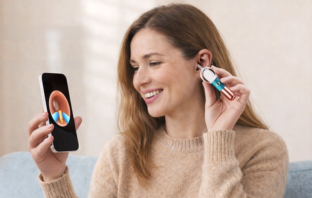 Smart Camera Otoscope Bebird Earsight Ultra 20MP (1)