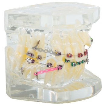 Dental model jaw teeth braces