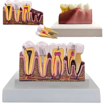 Anatomical Tooth Model for Dental Education with Removable Cross Section Tooth