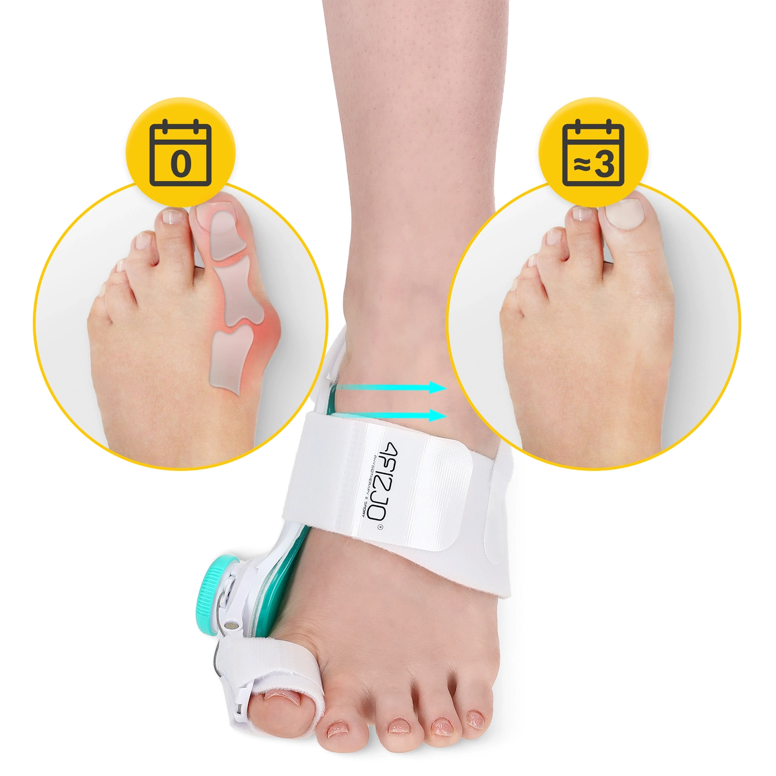 4Fizjo 1338 Adjustable Bunion Corrector with Knob